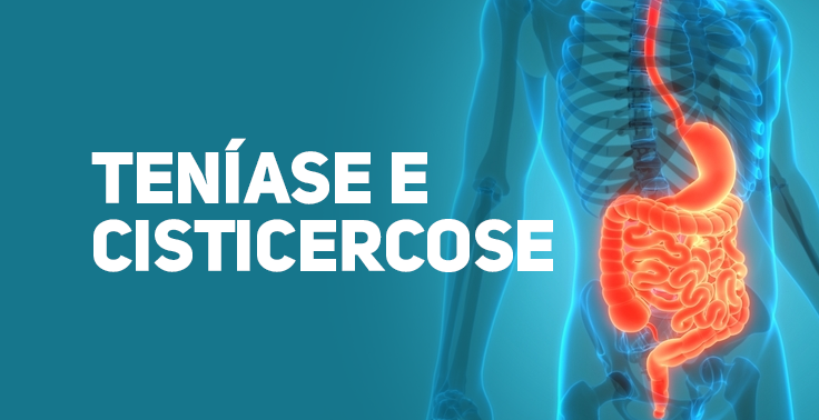 Imagem com fundo azul-esverdeado contendo o texto TENÍASE E CISTICERCOSE em letras maiúsculas e na cor branca, posicionado no lado esquerdo em duas linhas. No lado direito, há uma ilustração anatômica tridimensional do trato digestório humano, destacando o esôfago, o estômago e o sistema intestinal em tom vermelho e alaranjado brilhante dentro da silhueta translúcida de um tronco humano.